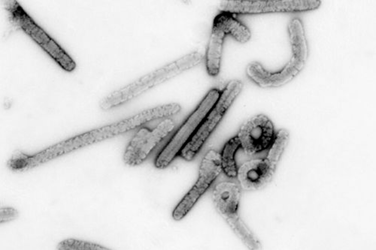 Прорыв в борьбе с вирусом Эбола: инновационные наноингибиторы открывают новые перспективы лечения 8a5c9f0b-a170-4dd8-b0ff-491f96af638a-67d1217a
