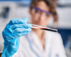 proryv v diagnostike bolezni alczgejmera cherez analiz 243 ot uchenyh vashingtonskogo i lundskogo universitetov-t-nw-ru-174361790300-0