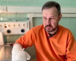 Успешная операция по спасению руки в Центре микрохирургии ГКБ Ерамишанцева uspeshnaya operacziya po spaseniyu ruki v czentre mikrohirurgii gkb eramishanczeva-t-nw-ru-174462516800-0