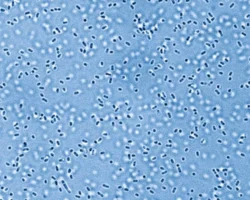 Мария Глория Домингес-Бейо и Мартин Блейзер запускают проект Ной для микробов при поддержке Университета Цюриха mariya gloriya domingesbejo i martin blejzer zapuskayut proekt noj dlya mikrobov pri podderzhke universiteta czyuriha-t-nw-ru-0