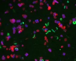 Руй Мануэл Рейс и роль Fusobacterium nucleatum в прогнозе рака головы и шеи ruj manuel rejs i rol v prognoze raka golovy i shei-t-nw-ru-0