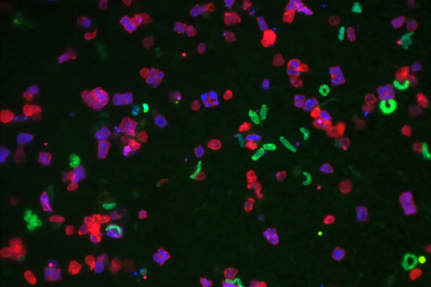 Руй Мануэл Рейс и роль Fusobacterium nucleatum в прогнозе рака головы и шеи-0