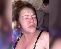 Удивительная история исцеления Алешии Роджерс после реакции на ибупрофен udivitelnaya istoriya isczeleniya aleshii rodzhers posle reakczii na ibuprofen-t-nw-ru-0