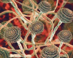 Александра Филёва из Гемотест о защите дома от грибка Aspergillus aleksandra filyova iz gemotest o zashhite doma ot gribka -t-nw-ru-0