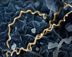 Открытие древнего Treponema pallidum в Колумбии удивило ученых otkrytie drevnego v kolumbii udivilo uchenyh-t-nw-ru-0