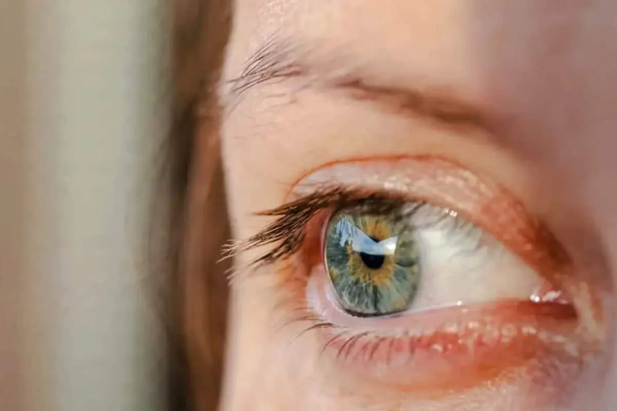 Синдром сухого глаза в Тайване — ранний признак аутоиммунных болезней-0