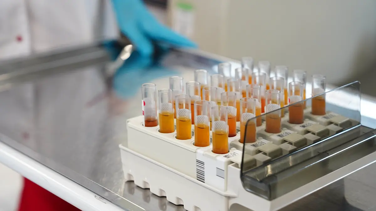 Допинг-проба российского акробата Кузьмина дала положительный результат