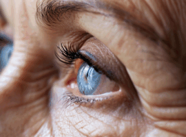 3 способа убрать морщины вокруг глаз - советы от Натальи Ткаченко и Roz Mary 3 sposoba ubrat morshhiny vokrug glaz sovety ot natali tkachenko i -tstpp-ru-174497197300-0