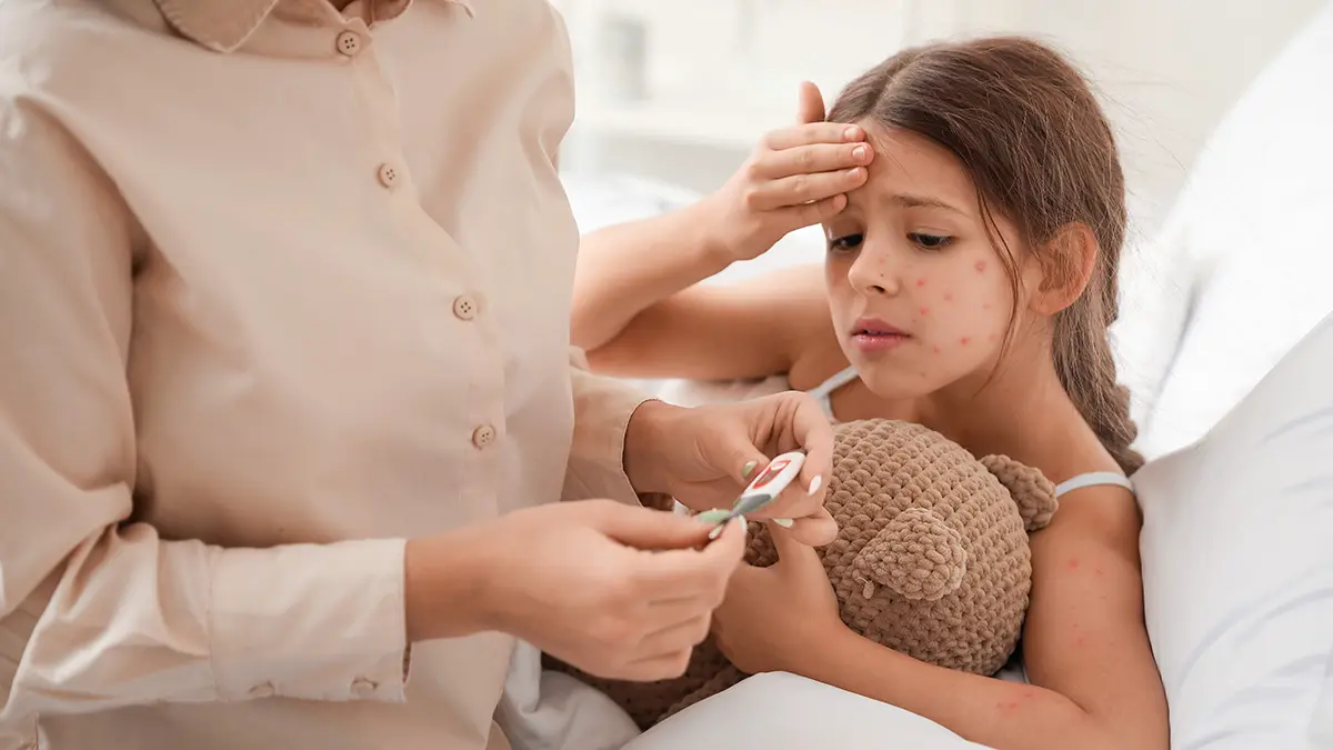 Как защититься от ветрянки без вакцины