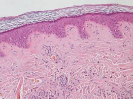 permskij politeh sozdal kompyuternuyu model dlya issledovaniya epitelialnoj tkani v onkologii i diabete-tstpp-ru-0
