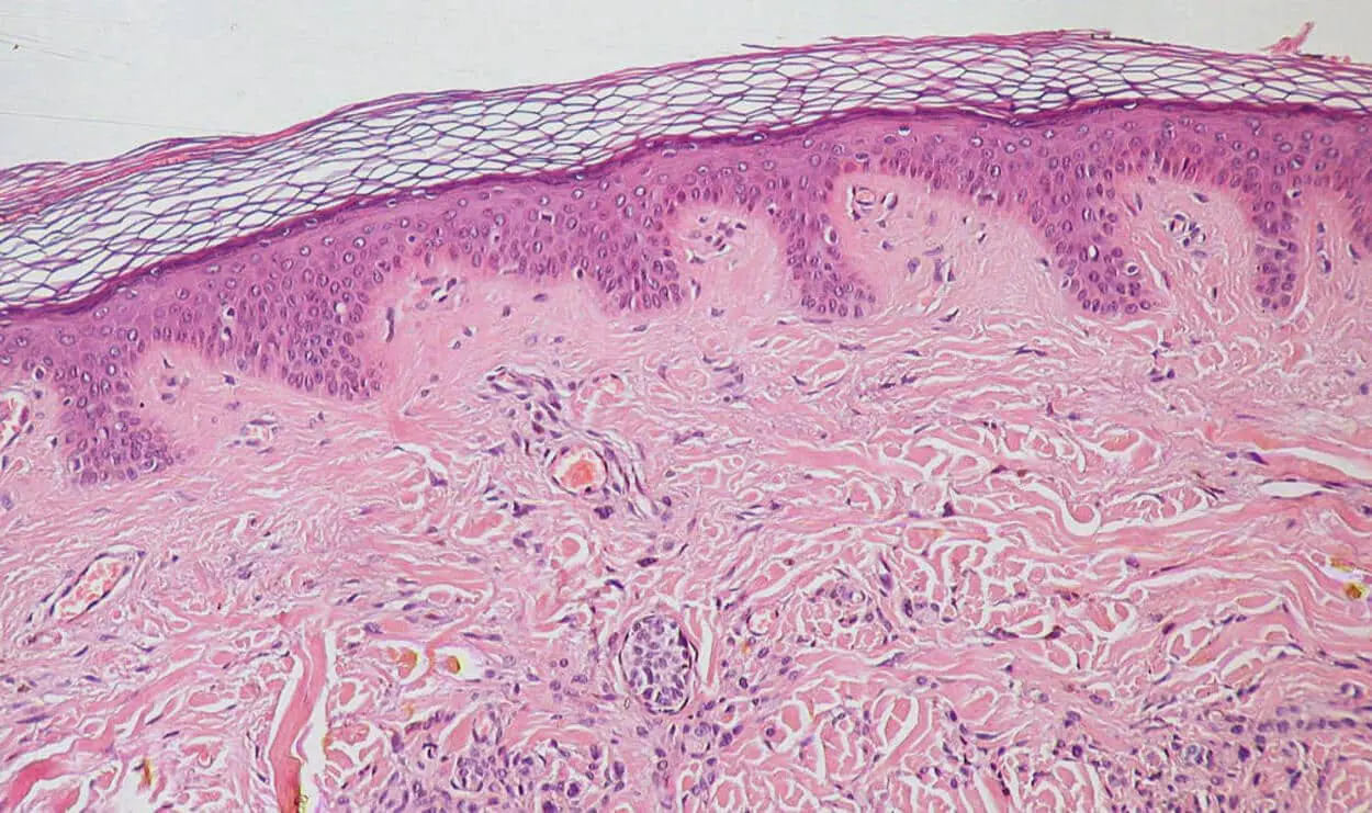 Пермский Политех создал компьютерную модель для исследования эпителиальной ткани в онкологии и диабете-0