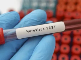 Роспотребнадзор выявил норовирус в школе «Созвездие» Арзамаса и принял меры rospotrebnadzor vyyavil norovirus v shkole sozvezdie arzamasa i prinyal mery-tstpp-ru-0