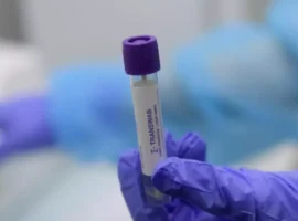 ВИЧ-положительная пациентка из Калуги перенесла новый COVID-19 долгое время vichpolozhitelnaya paczientka iz kalugi perenesla novyj 19 dolgoe vremya-tstpp-ru-0