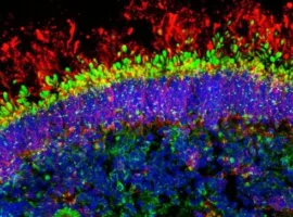 Робин Джеймисон и Институт Сиднейского университета открывают новые перспективы диагностики ВАЛ и RPGRIP1 robin dzhejmison i institut sidnejskogo universiteta otkryvayut novye perspektivy diagnostiki val i 1-tstpp-ru-0
