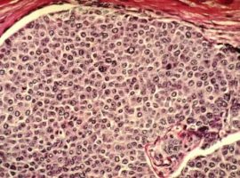 Ученые ПНИПУ раскрыли влияние невесомости на цитоскелет раковых клеток uchenye pnipu raskryli vliyanie nevesomosti na czitoskelet rakovyh kletok-tstpp-ru-0