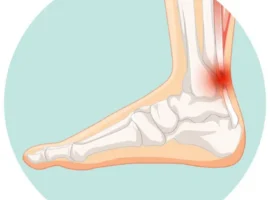 Биофизики ИТЭБ РАН успешно испытали замену сухожилий на крысах biofiziki iteb ran uspeshno ispytali zamenu suhozhilij na krysah-tstpp-ru-0