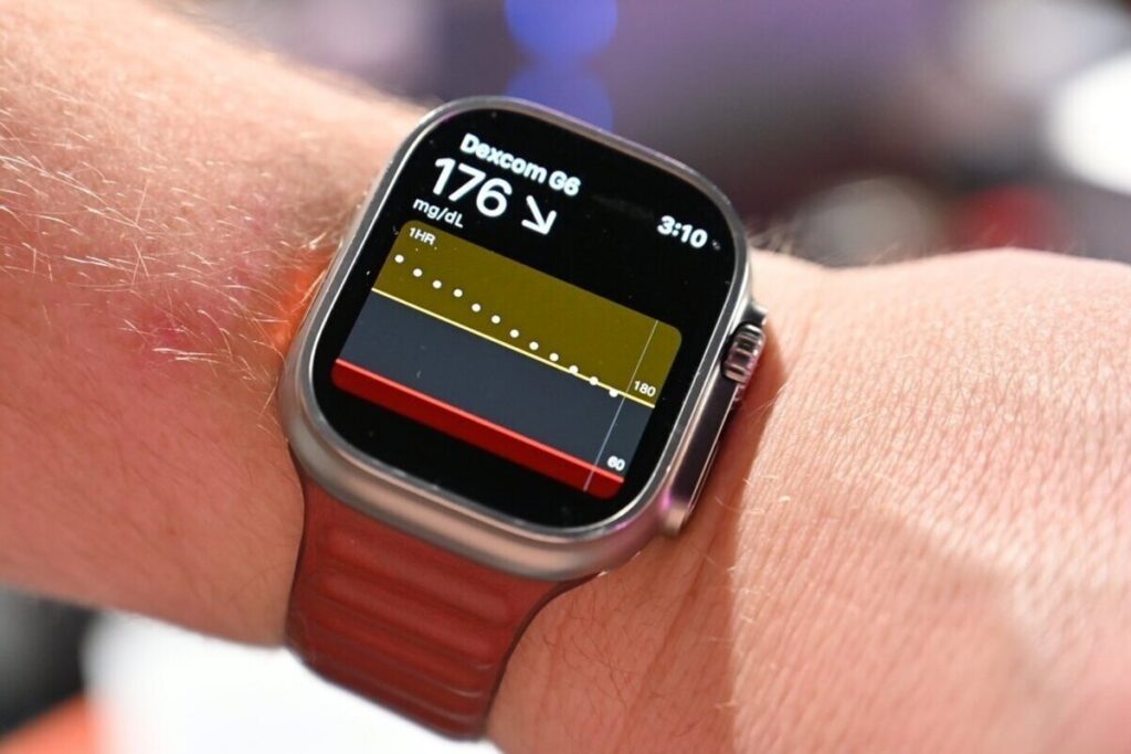 Мониторинг уровня глюкозы на Apple Watch