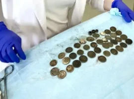 Минздрав Волгограда и Морозовская больница провели успешную операцию minzdrav volgograda i morozovskaya bolnicza proveli uspeshnuyu operacziyu-tstpp-ru-0
