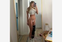 Известная волейболистка Кайла Симмонс поделилась фото во время реабилитации 67d657b8-cb4b-41db-9eb2-aac641c62809-67b3b88a