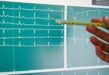 Здоровый образ жизни: как простые привычки помогут сохранить здоровье сердца и сосудов Работа павильона Здоровая Москва в сквере на бульваре Генерала Карбышева