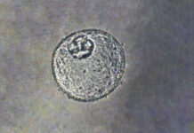 Инновационный прорыв: экономичный метод создания мини-органов открывает новые горизонты в медицине ddd1df8f-1cef-4d92-b4df-a21c09b1df0b-67cd20e2