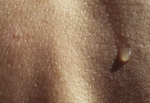 Простые правила питания для красивой и здоровой кожи 9848cc9e-9517-4cf7-9cf9-33058bbc0366-67f6b023