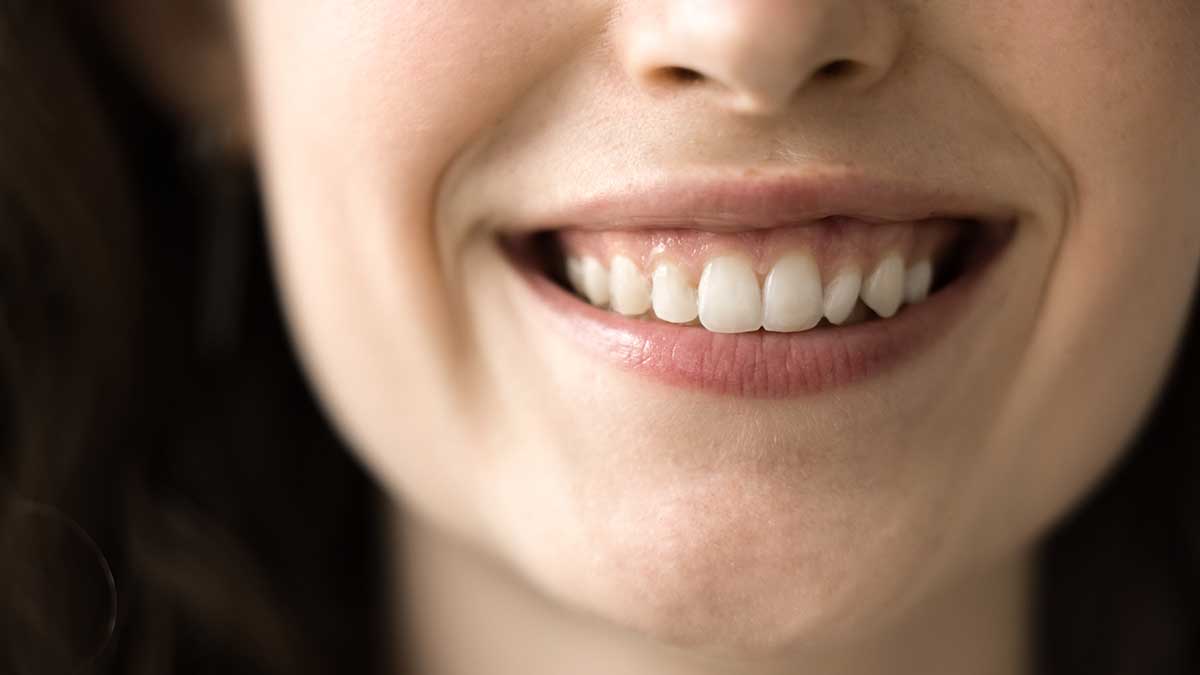 Можно ли выровнять зубы после 40 лет