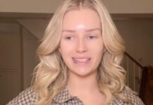 Лотти Мосс восхищает естественной красотой после процедуры удаления филлеров lotti moss voshishhaet estestvennoj krasotoj posle proczedury udaleniya fillerov-ekbonline-ru-174178990500-0