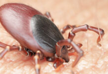 Ляман Нуриева из Олимп Клиник МАРС о защите от клещей и важности профилактики энцефалита lyaman nurieva iz olimp klinik mars o zashhite ot kleshhej i vazhnosti profilaktiki enczefalita-ekbonline-ru-174232359900-0