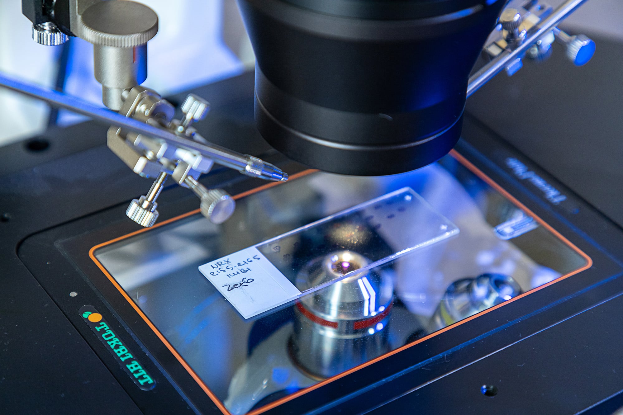 Прорыв в изучении гена Spout1 открывает новые возможности для здоровья детей в России-0