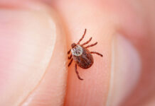 Азамат Кунафин раскрыл секреты зимовки клещей и советы Михаила Воробьева для защиты DangerOfTickBiteShowsClose-upMiteInTheHand