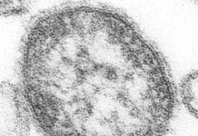 Мунту Дэвис утверждает, что прививка от кори защищает детей от осложнений muntu devis utverzhdaet chto privivka ot kori zashhishhaet detej ot oslozhnenij-ekbonline-ru-0