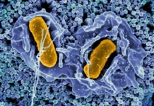 Самоуничтожающаяся Сальмонелла активирует иммунитет при лечении колоректального рака samounichtozhayushhayasya salmonella aktiviruet immunitet pri lechenii kolorektalnogo raka-ekbonline-ru-0