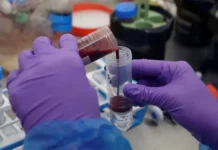 Университет Иллинойса в Чикаго исследует PF4 и стволовые клетки для омоложения крови universitet illinojsa v chikago issleduet 4 i stvolovye kletki dlya omolozheniya krovi-ekbonline-ru-0