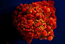 Химиотерапия целенаправленно уничтожает латентные резервуары ВИЧ himioterapiya czelenapravlenno unichtozhaet latentnye rezervuary vich-ekbonline-ru-0