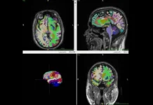 Искусственный интеллект подтверждает, что мышечная масса замедляет старение мозга iskusstvennyj intellekt podtverzhdaet chto myshechnaya massa zamedlyaet starenie mozga-ekbonline-ru-0