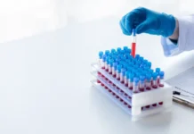 В МГУ сделали прорыв в анализе эритроцитов с помощью лазерной дифрактометрии v mgu sdelali proryv v analize eritroczitov s pomoshhyu lazernoj difraktometrii-ekbonline-ru-0