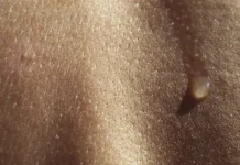 Дерматолог советует: Как сохранить мягкость и здоровье кожи рук dermatolog sovetuet kak sohranit myagkost i zdorove kozhi ruk-ekbonline-ru-0