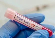 Эксперт Никифоров: вирус Нипах для России не опасен ekspert nikiforov virus nipah dlya rossii ne opasen-ekbonline-ru-0