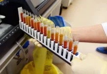 Георгий Невинский и СО РАН открыли новое в аутоиммунных заболеваниях georgij nevinskij i so ran otkryli novoe v autoimmunnyh zabolevaniyah-ekbonline-ru-0