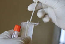 Роспотребнадзор проверяет случай оспы обезьян в Московской области rospotrebnadzor proveryaet sluchaj ospy obezyan v moskovskoj oblasti-ekbonline-ru-0