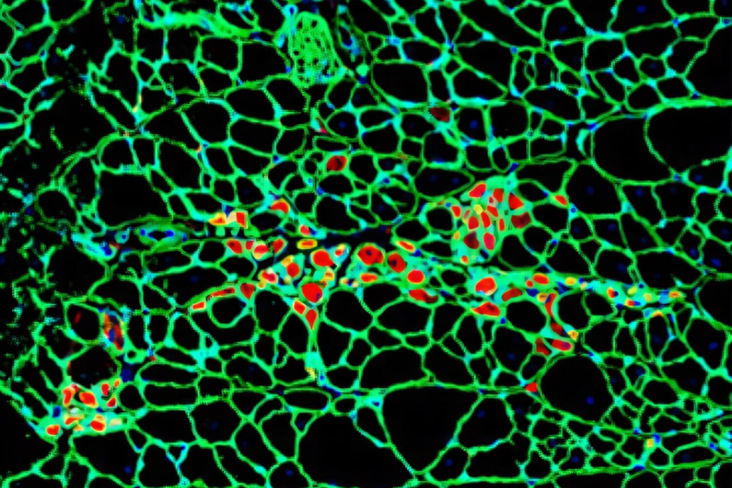 Институт рака имени Хелен Грэм и Human Cell Atlas раскрывают порядок клеток-0