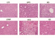 molli r gallop iz universiteta yuty razobrala polzu i riski ketogennoj diety-infovzor-ru-0