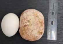 Врачи Балаковской клинической больницы спасли 65-летнего пациента с уникальным случаем vrachi balakovskoj klinicheskoj bolniczy spasli 65letnego paczienta s unikalnym sluchaem-infovzor-ru-0