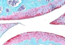 Стэнфордский университет создает препарат для омоложения хряща с помощью 15-PGDH stenfordskij universitet sozdaet preparat dlya omolozheniya hryashha s pomoshhyu 15-infovzor-ru-0