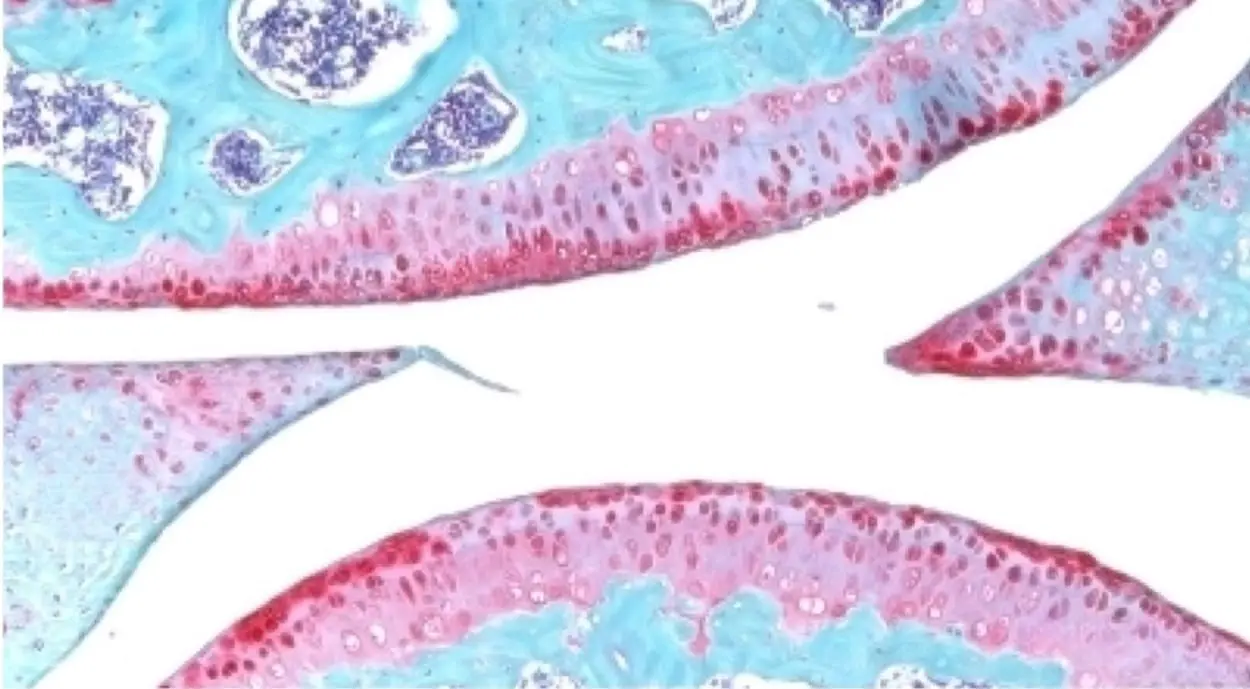 Стэнфордский университет создает препарат для омоложения хряща с помощью 15-PGDH-0