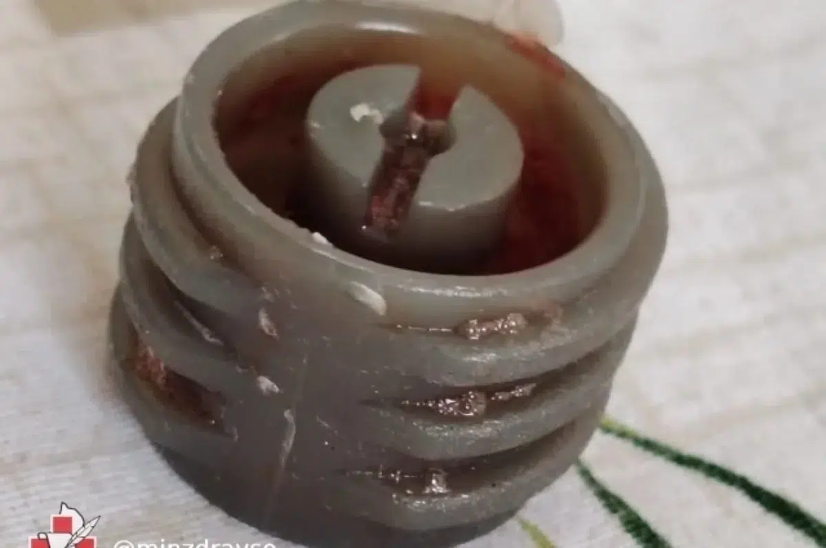 Уникальная операция в Североуральской горбольнице спасла жизнь ребёнка-0