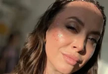 Наталья Фриске демонстрирует вдохновляющий пример силы духа в борьбе с недугом natalya friske demonstriruet vdohnovlyayushhij primer sily duha v borbe s nedugom-stanural-ru-174843278800-0