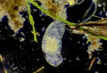 Церкариоз и его симптомы: как сохранить здоровье во время купания czerkarioz i ego simptomy kak sohranit zdorove vo vremya kupaniya-stanural-ru-174896321100-0