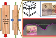 Научное объяснение появления морщин от Бингемтонского университета nauchnoe obyasnenie poyavleniya morshhin ot bingemtonskogo universiteta-stanural-ru-0